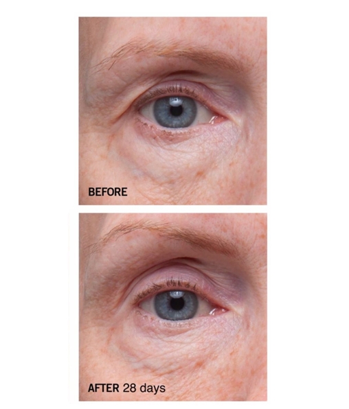Ferulic Retinol Triple Correction Eye Serum