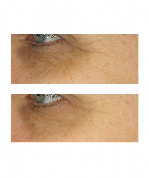 Booster Serum
